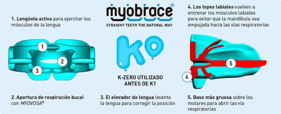 Myobrace K - Pacific Orthodontics